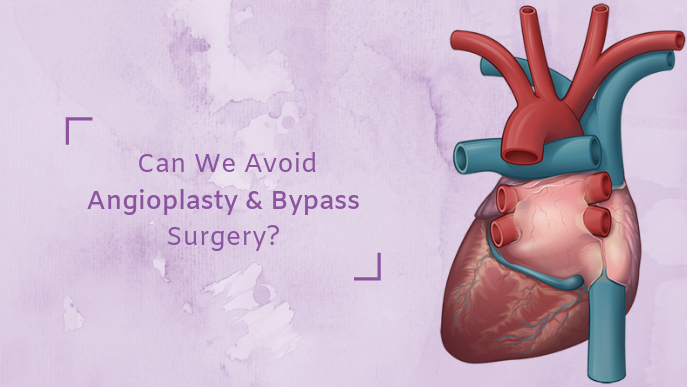 No Need To Go For Angioplasty Bypass Surgery For Heart Problems 1
