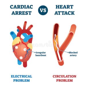 Difference between cardiac arrest and heart attack