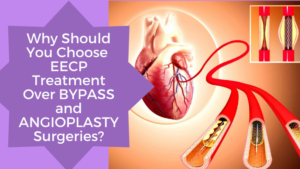 Why should you choose EECP Treatment over BYPASS and ANGIOPLASTY surgeries